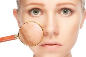 Scar Treatment Market